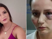 Izjasnio se vlasnik hotela Jablanica: Tvrdi da nije kriv za premlaćivanje Enise Klepo