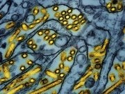 Cijela Austrija proglašena rizičnim područjem zbog pojave zarazne bolesti!