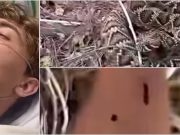 (VIDEO)Influenser dopustio da ga ugrize zmija zbog pregleda,iz bolnice izjavio: “Strah me da ću umrijeti..”
