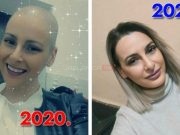 Jasmina prošla 31 zračenje i 16 kemoterapija, danas s ponosom kaže “Uspjela sam”: Ova slika je simbol pobjede