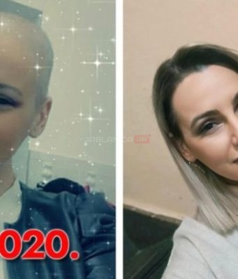 Jasmina prošla 31 zračenje i 16 kemoterapija, danas s ponosom kaže “Uspjela sam”: Ova slika je simbol pobjede