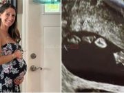 (VIDEO)Mama doživjela šok na ultrazvuku: Nije ni slutila kakav prizor će je dočekati