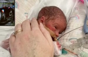 Beba je rođena s tumorom duplo većim od nje, no Bog nije dopustio da umre