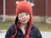 (VIDEO)Zlostavljana djevojčica s tumorom je svima pokazala da je ništa ne može slomiti