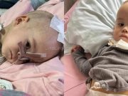 Hitna pomoć potrebna za malenog Dimitrija da pobijedi tumor, već je prošao pet operacija na mozgu