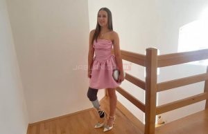 Zbog raka ostala bez noge: Marija je na maturskoj večeri protezu nosila s ponosom