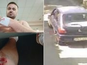 Potraga za vozačem plave Fieste: Izgurao motociklistu u Vrapčićima sa puta, ostavio ga da leži u jarku!(FOTO)